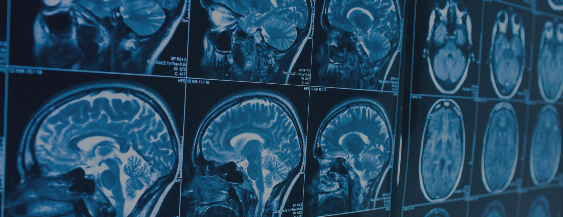 brain scan film